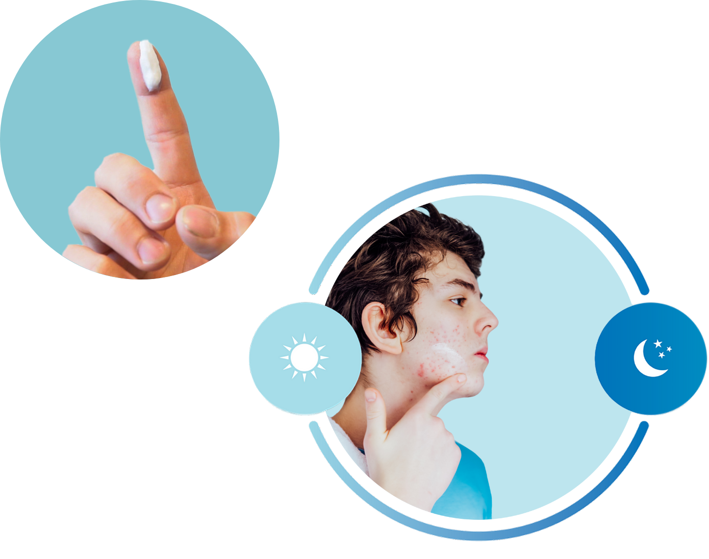 Step 2 — apply WINLEVI cream